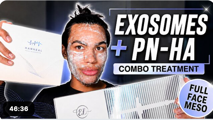 Hanheal Exosomes + Elaxen PN HA | Full Face Meso
