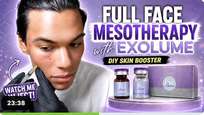 Full Face ExoLume Mesotherapy Live | DIY Exosome Skin Booster Treatment