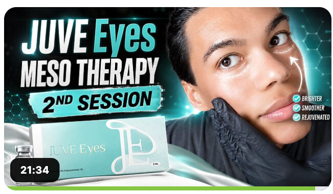 Juve Eyes Under Eye Mesotherapy DIY Polynucleotide Treatment Session 2