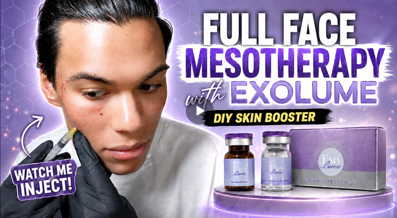 Full Face ExoLume Mesotherapy Live | DIY Exosome Skin Booster Treatment