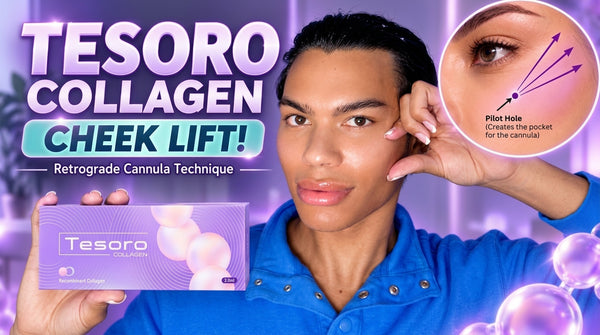 Tesoro Collagen CHEEK LIFT! | Retrograde Cannula + First Impressions