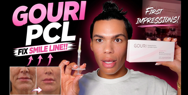 GOURI PCL ON NASOLABIAL FOLDS 😳 | Fixing My Smile Lines + First Impressions!