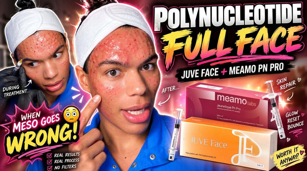 POLYNUCLEOTIDE FULL FACE 😳 Juve Face + Meamo PN Pro